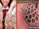 Trypophobia Disease- The Fear of Holes