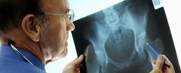 5 Orthopaedic-related Diseases you Need to Know