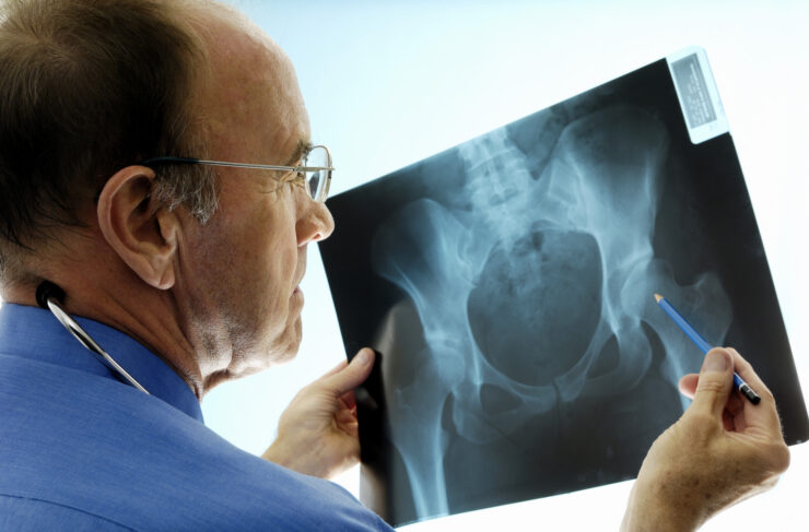 5 Orthopaedic-related Diseases you Need to Know