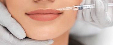 Lip fillers